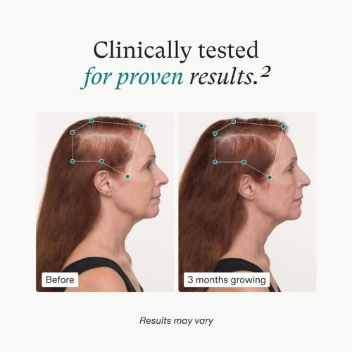 Nutrafol Women's Balance Hair Growth Supplements - 120 Capsules Refill